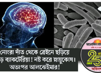 বাচ্চাদের দাঁতের যত্ন নিয়ে যারা অবহেলা করেন ?
